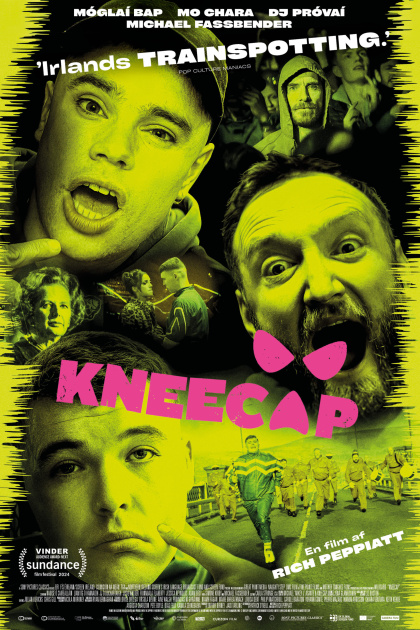 Kneecap